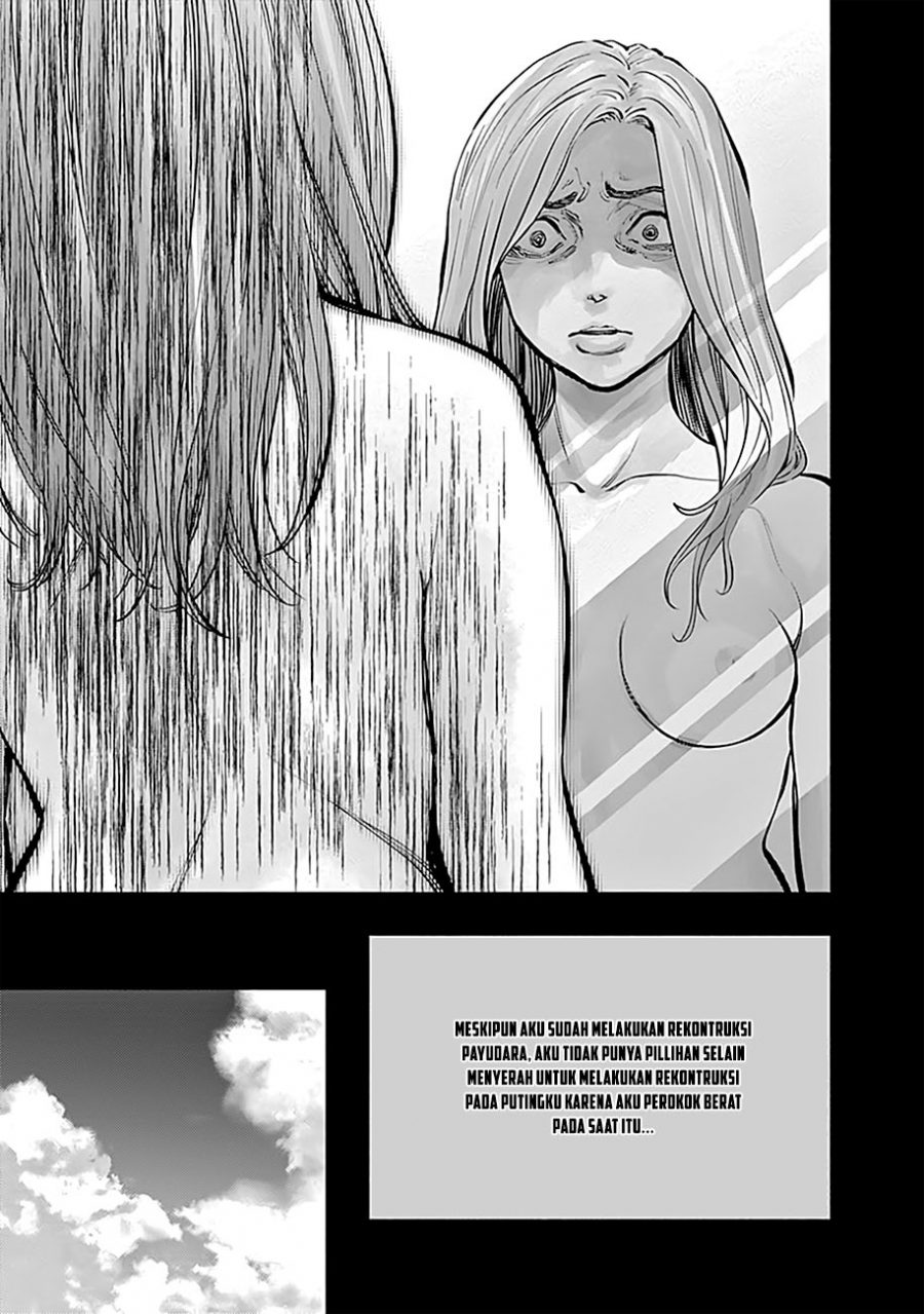 Radiation House Chapter 14 Bahasa Indonesia